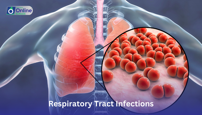 Lesson 08: Respiratory Tract Infections